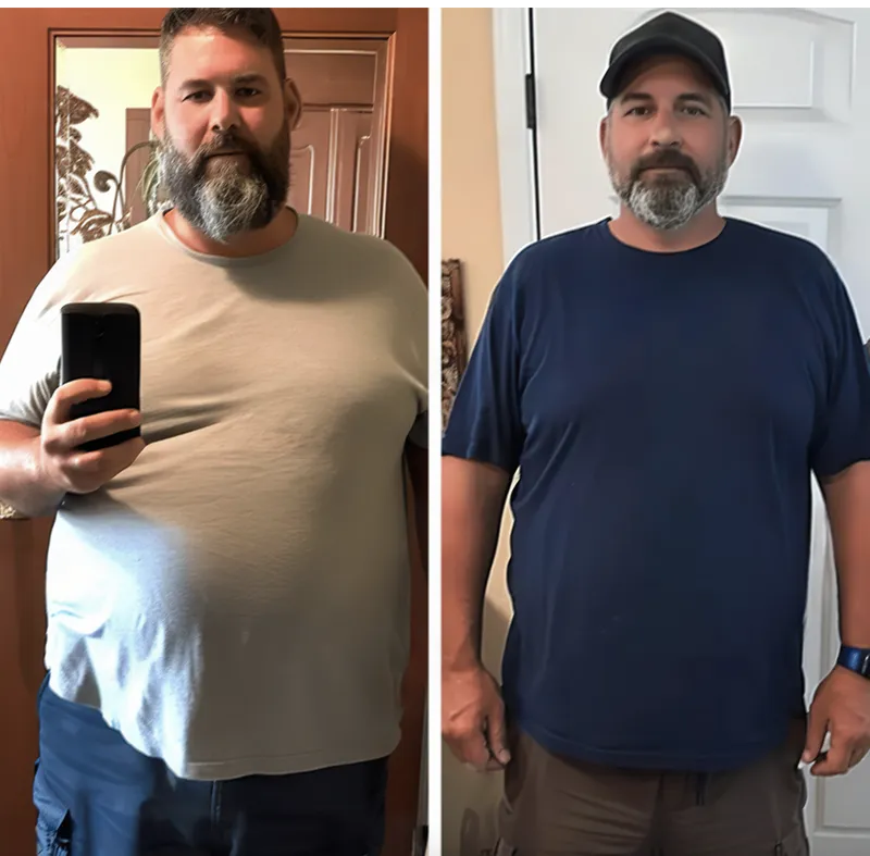 James, 41 before and after